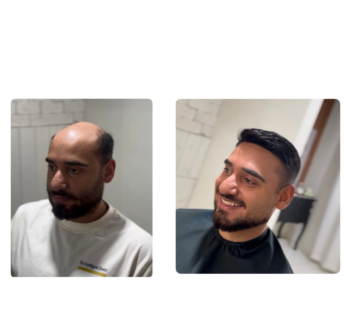 Antes & Depois